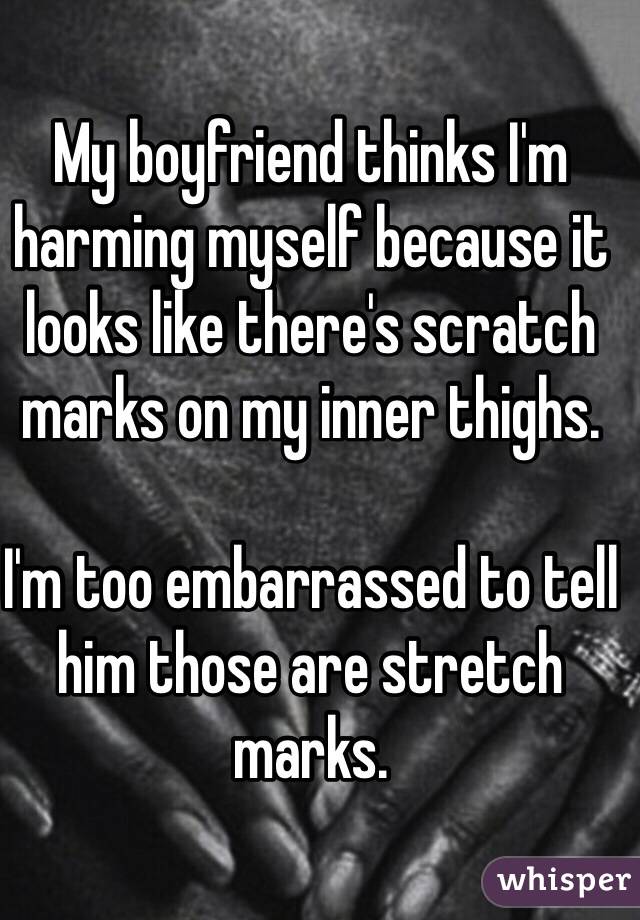 My boyfriend thinks I'm harming myself because it looks like there's scratch marks on my inner thighs.

I'm too embarrassed to tell him those are stretch marks.