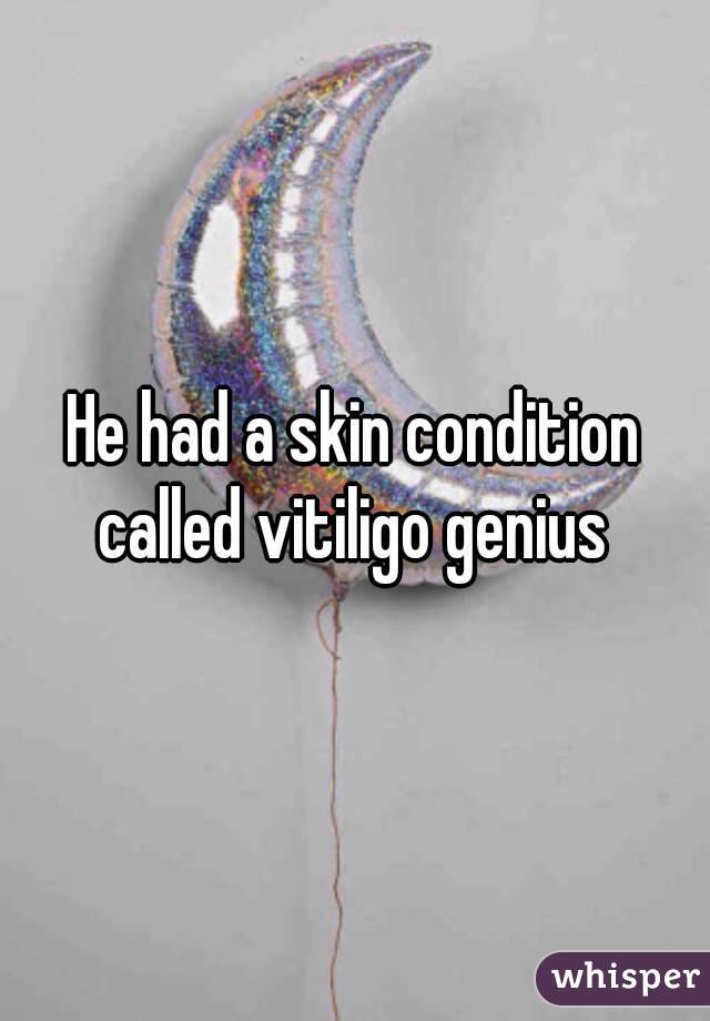 He had a skin condition called vitiligo genius 