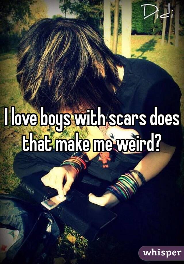 I love boys with scars does that make me weird? 