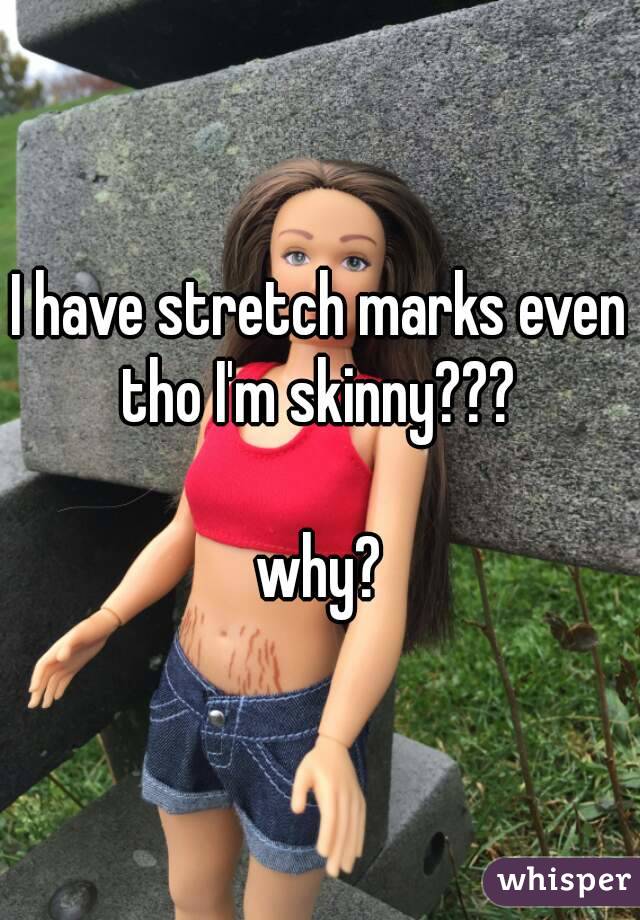 I have stretch marks even tho I'm skinny??? 

why?