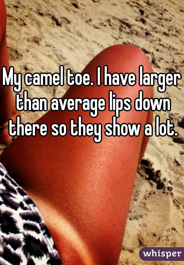 My camel toe. I have larger than average lips down there so they show a lot.