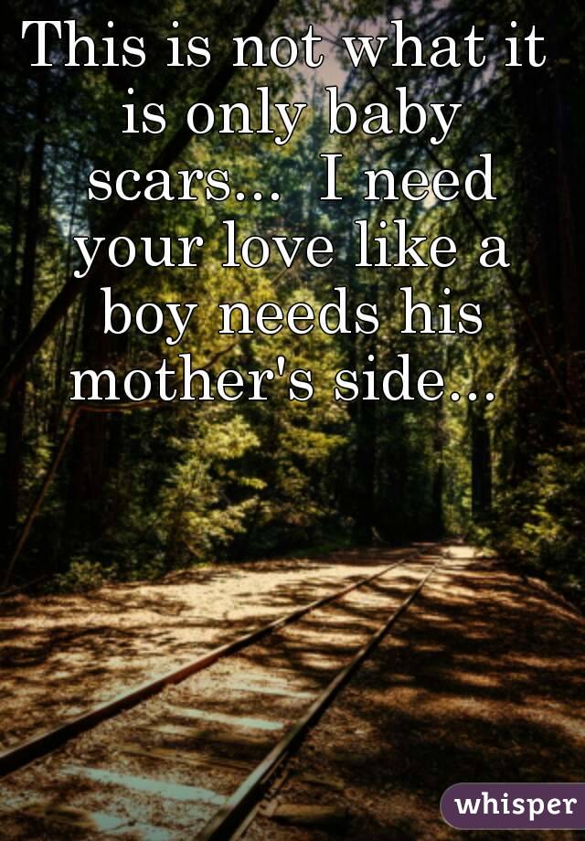 This is not what it is only baby scars...  I need your love like a boy needs his mother's side... 