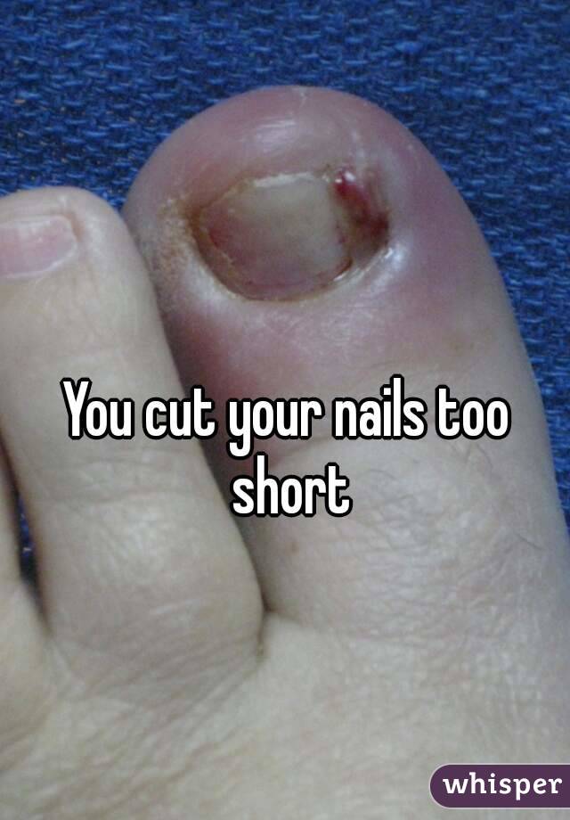 You cut your nails too short