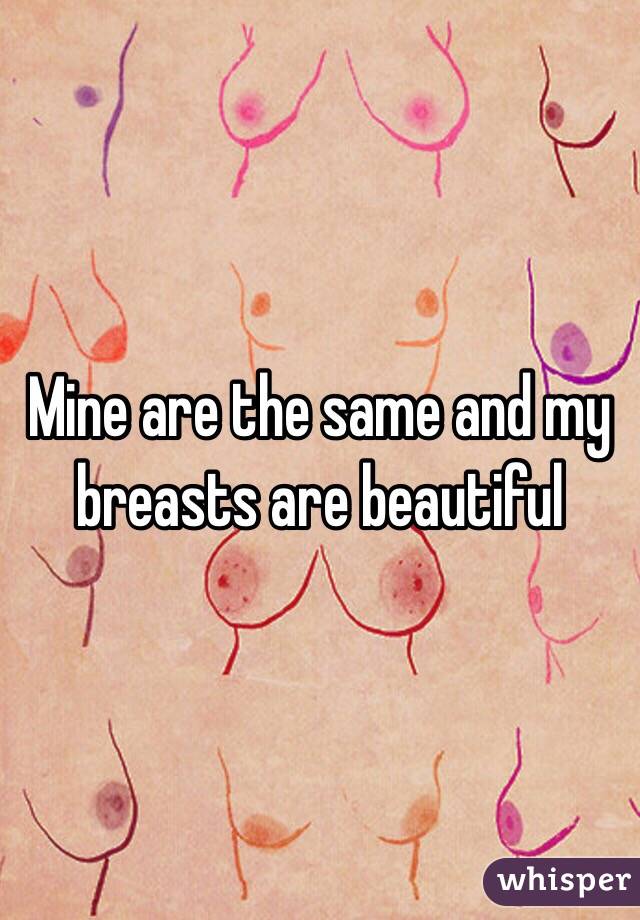 Mine are the same and my breasts are beautiful