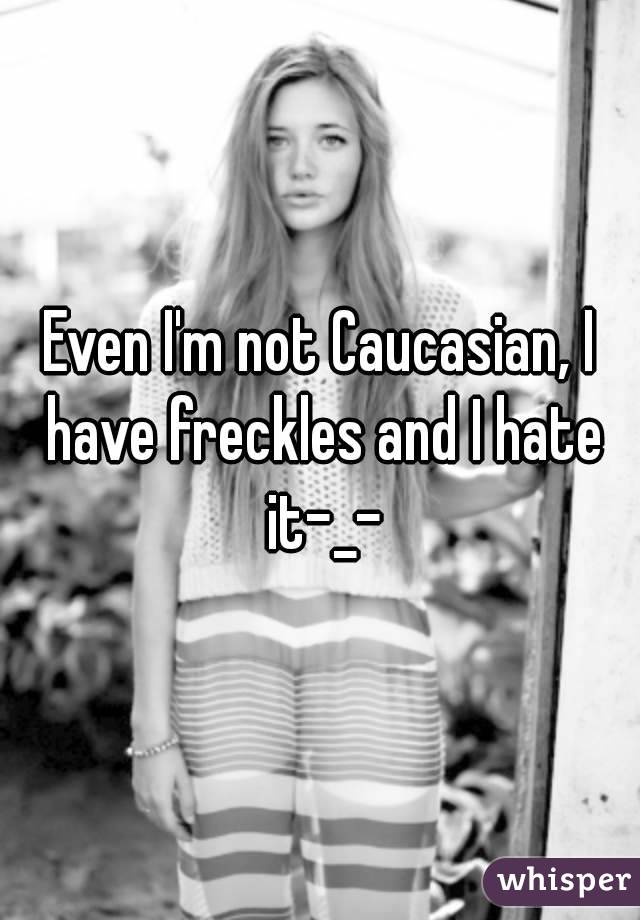 Even I'm not Caucasian, I have freckles and I hate it-_-