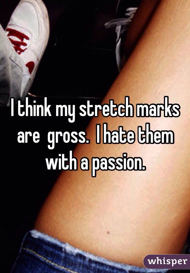 I think my stretch marks are  gross.  I hate them with a passion.  