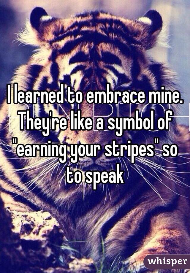 I learned to embrace mine. They're like a symbol of "earning your stripes" so to speak