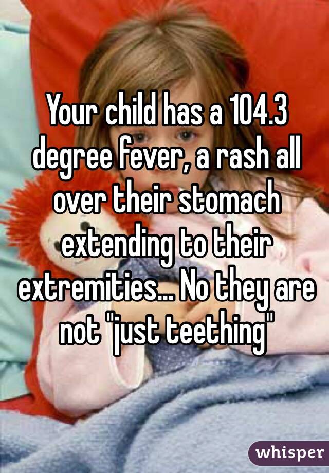 Your child has a 104.3 degree fever, a rash all over their stomach extending to their extremities... No they are not "just teething"