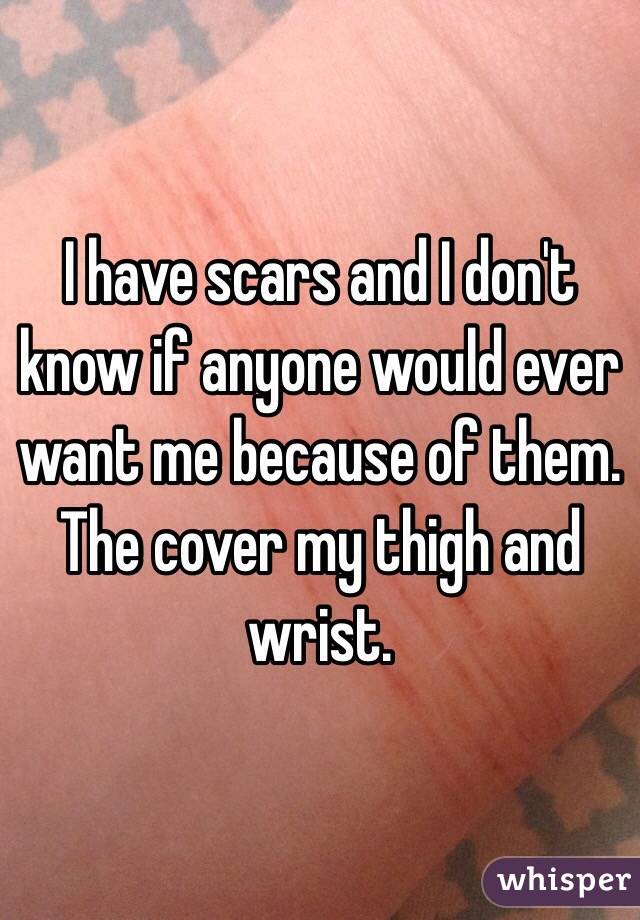 I have scars and I don't know if anyone would ever want me because of them. The cover my thigh and wrist. 