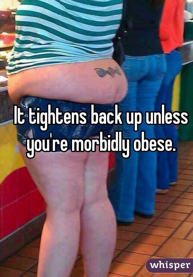 It tightens back up unless you're morbidly obese. 

