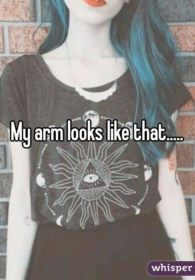 My arm looks like that.....