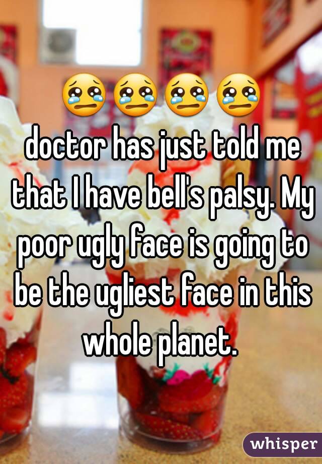 😢😢😢😢 doctor has just told me that I have bell's palsy. My poor ugly face is going to be the ugliest face in this whole planet. 