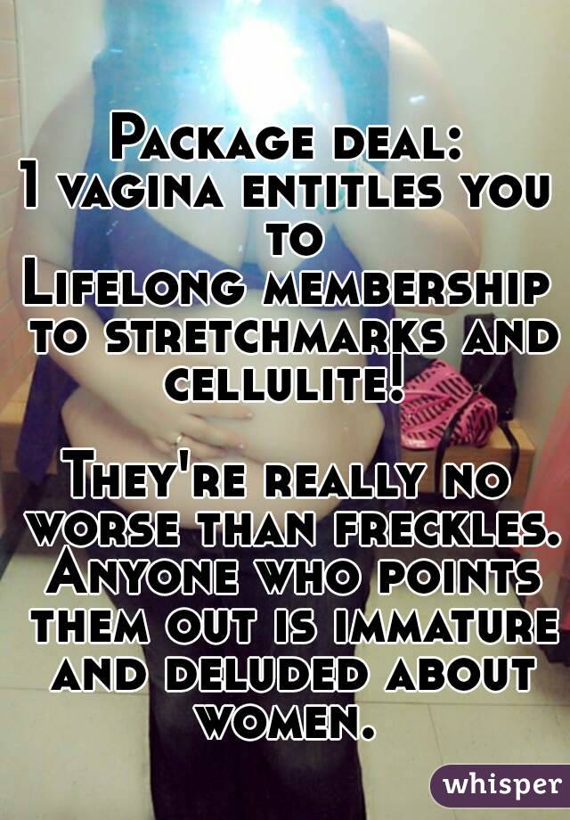 Package deal:
1 vagina entitles you to
Lifelong membership to stretchmarks and cellulite! 

They're really no worse than freckles. Anyone who points them out is immature and deluded about women. 



