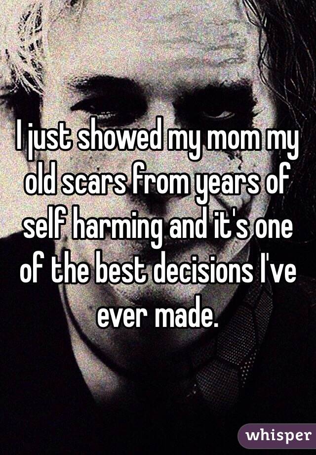 I just showed my mom my old scars from years of self harming and it's one of the best decisions I've ever made. 