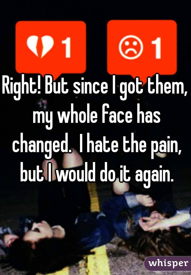 Right! But since I got them, my whole face has changed.  I hate the pain, but I would do it again.