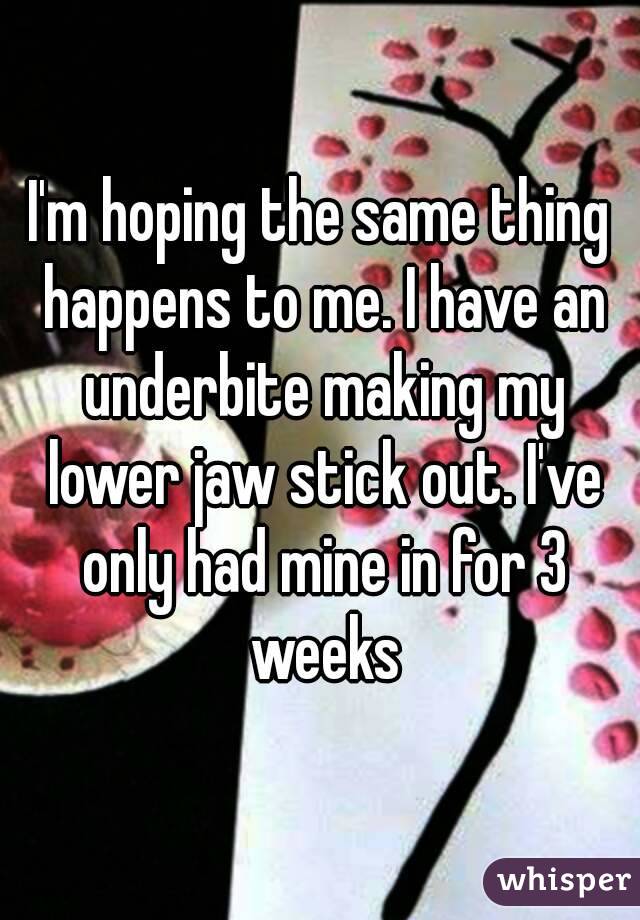 I'm hoping the same thing happens to me. I have an underbite making my lower jaw stick out. I've only had mine in for 3 weeks