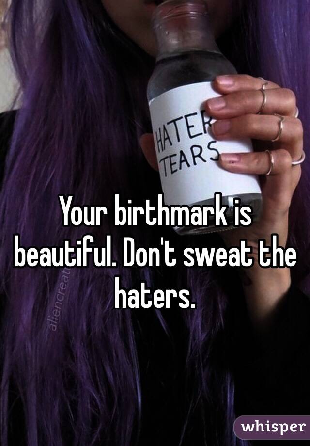 Your birthmark is beautiful. Don't sweat the haters.