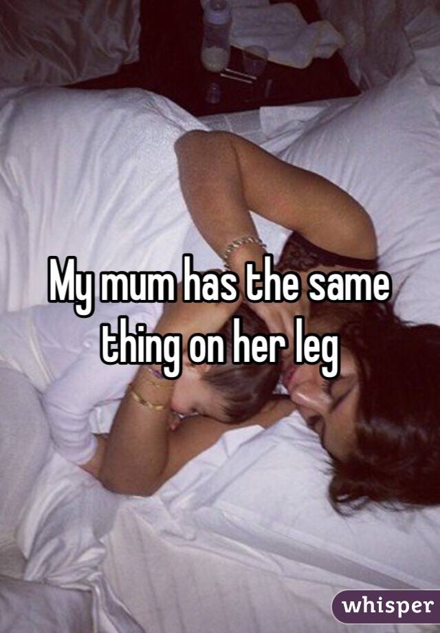 My mum has the same thing on her leg