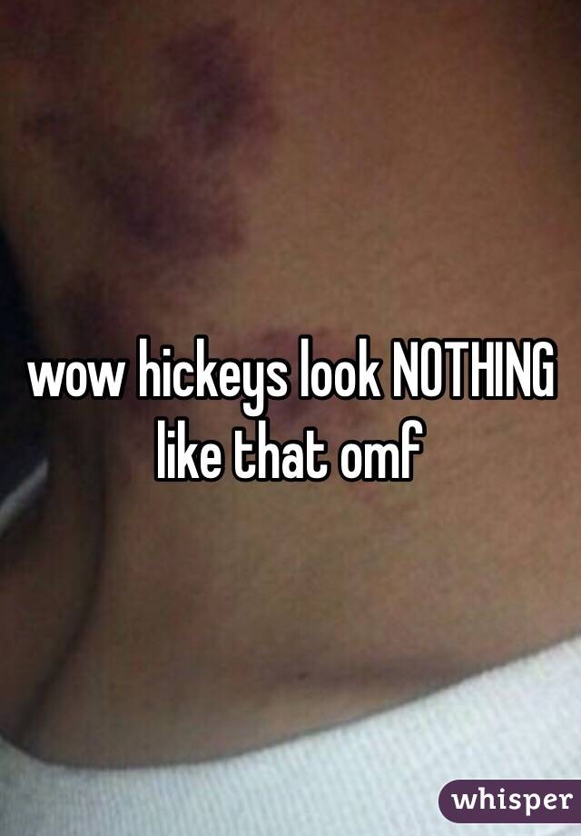 wow hickeys look NOTHING like that omf