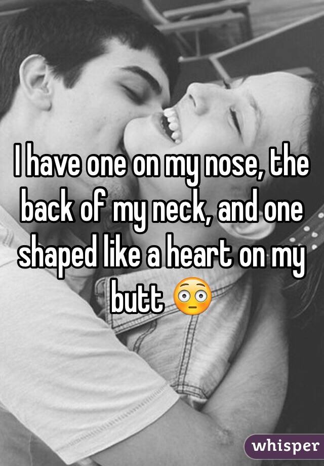 I have one on my nose, the back of my neck, and one shaped like a heart on my butt 😳