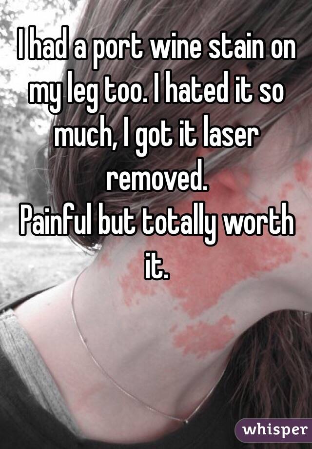 I had a port wine stain on my leg too. I hated it so much, I got it laser removed. 
Painful but totally worth it. 