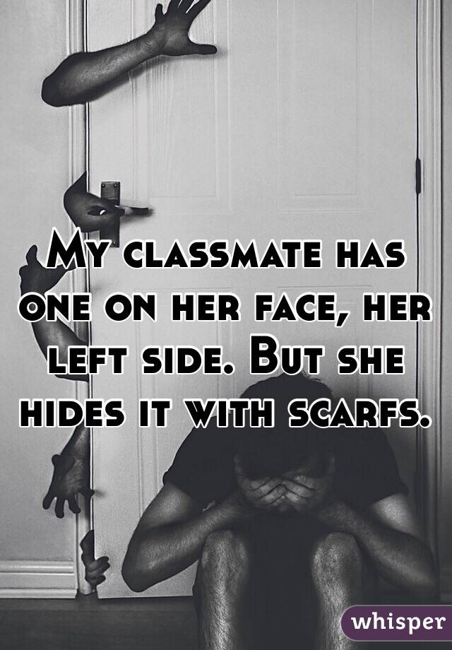 My classmate has one on her face, her left side. But she hides it with scarfs.