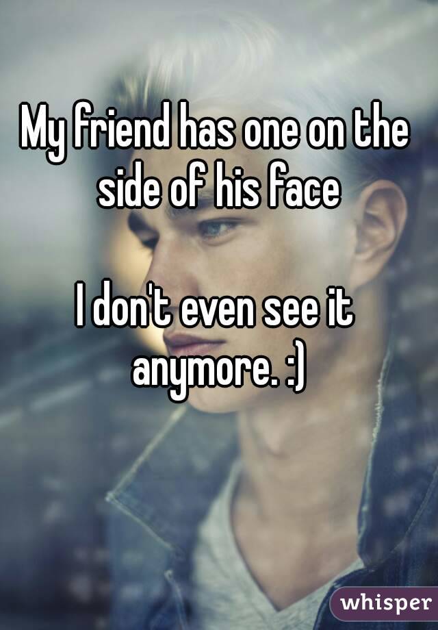 My friend has one on the side of his face

I don't even see it anymore. :)