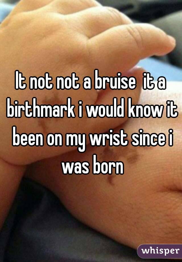 It not not a bruise  it a birthmark i would know it been on my wrist since i was born