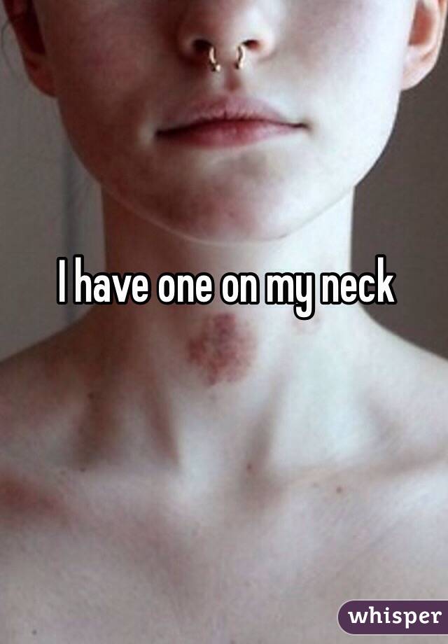 I have one on my neck
