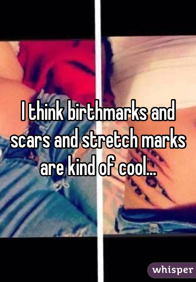 I think birthmarks and scars and stretch marks are kind of cool...