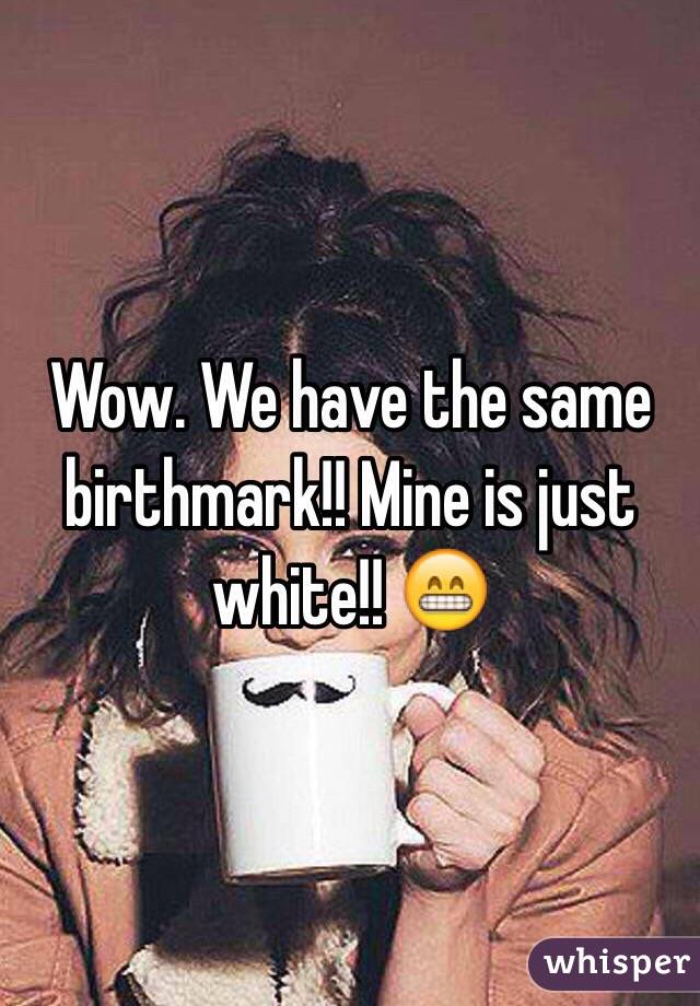 Wow. We have the same birthmark!! Mine is just white!! 😁