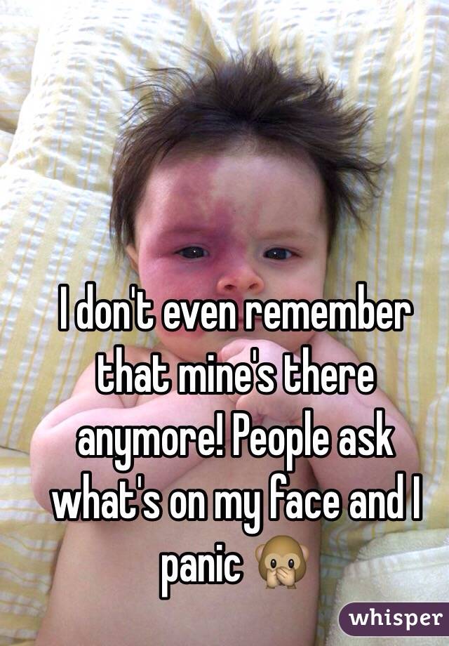 I don't even remember that mine's there anymore! People ask what's on my face and I panic 🙊