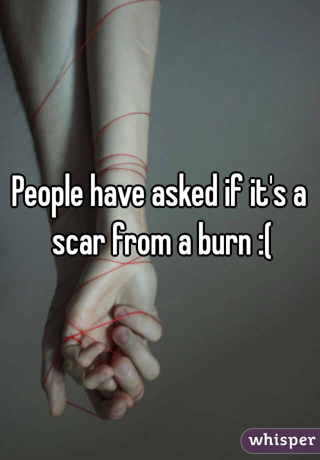 People have asked if it's a scar from a burn :(