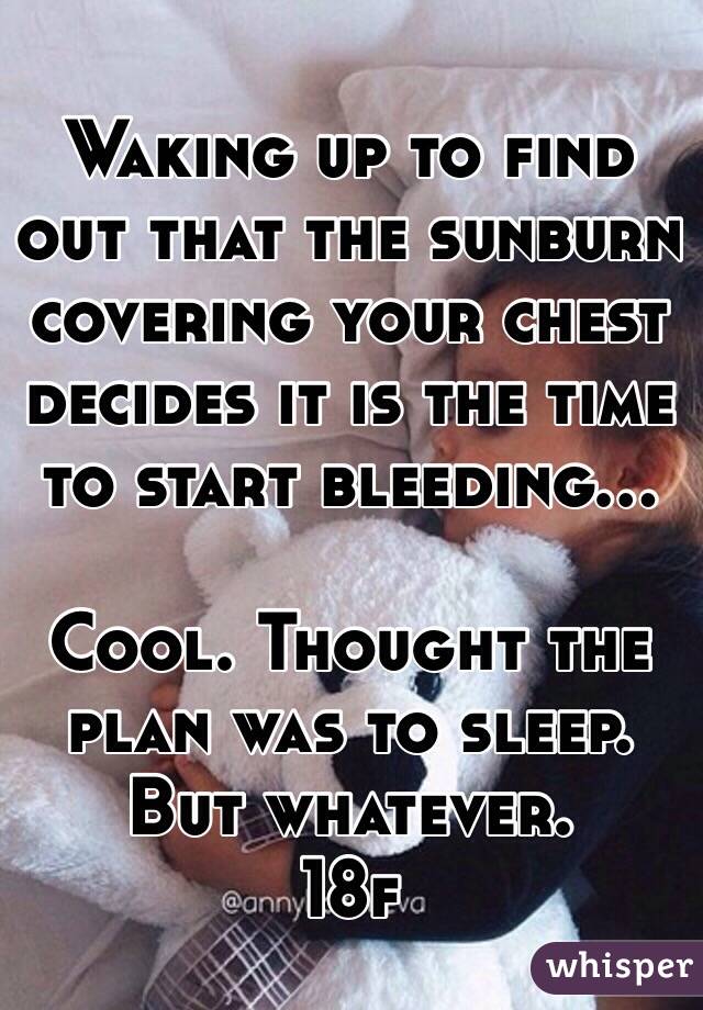 Waking up to find out that the sunburn covering your chest decides it is the time to start bleeding...

Cool. Thought the plan was to sleep. But whatever. 
18f 