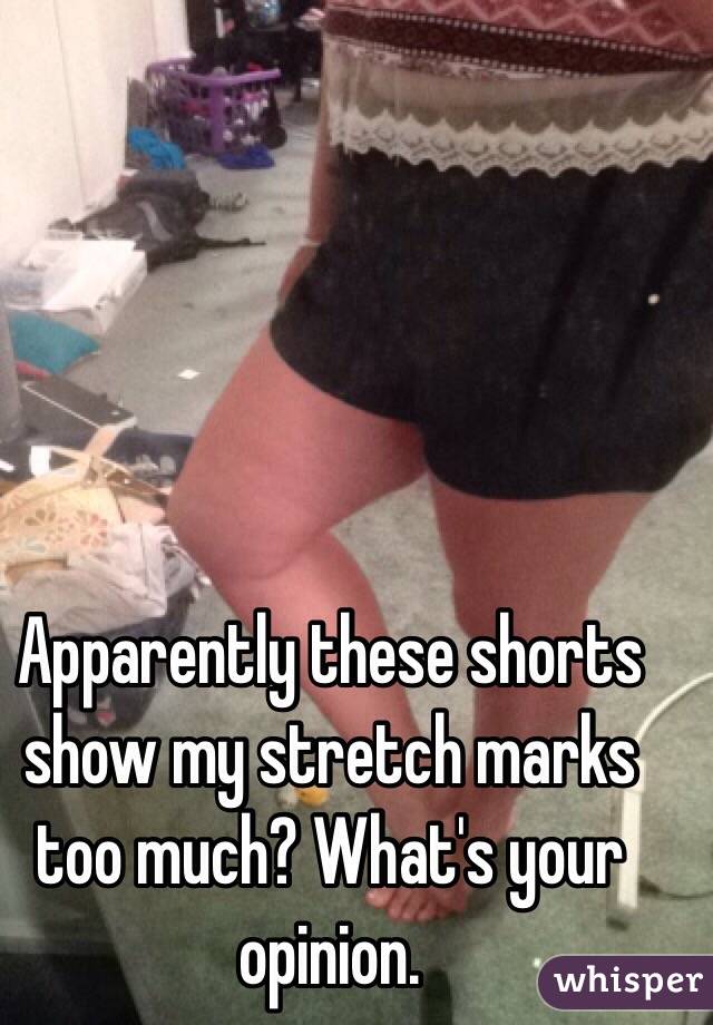 Apparently these shorts show my stretch marks too much? What's your opinion. 