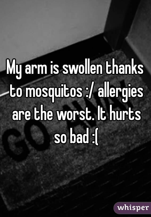 My arm is swollen thanks to mosquitos :/ allergies are the worst. It hurts so bad :(