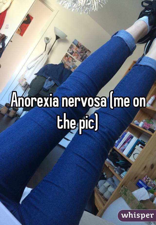 Anorexia nervosa (me on the pic) 