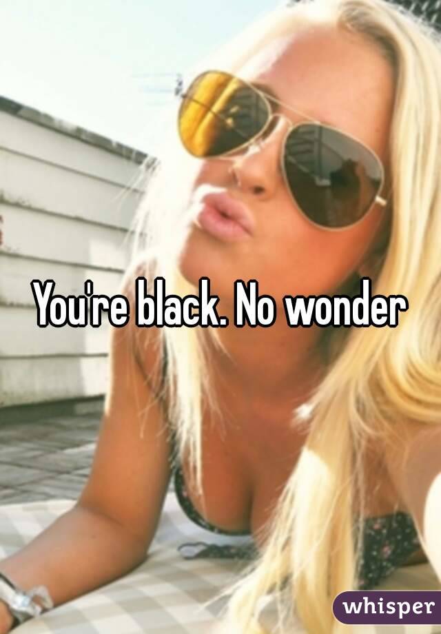 You're black. No wonder