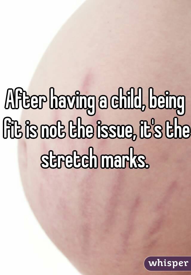 After having a child, being fit is not the issue, it's the stretch marks. 