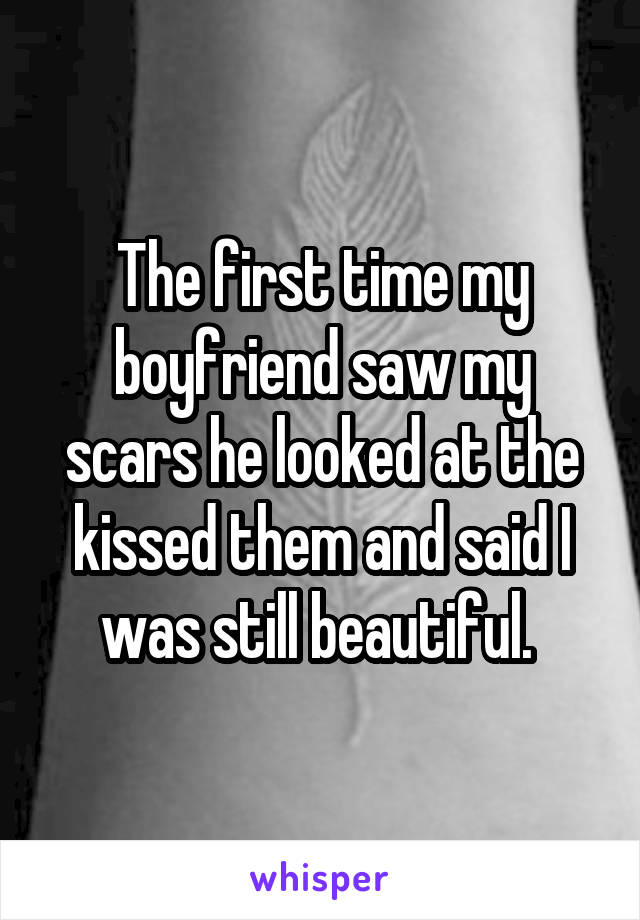 The first time my boyfriend saw my scars he looked at the kissed them and said I was still beautiful. 