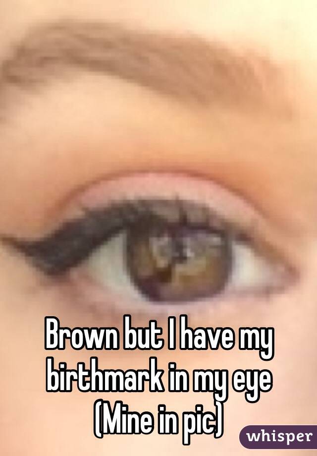 Brown but I have my birthmark in my eye 
(Mine in pic)