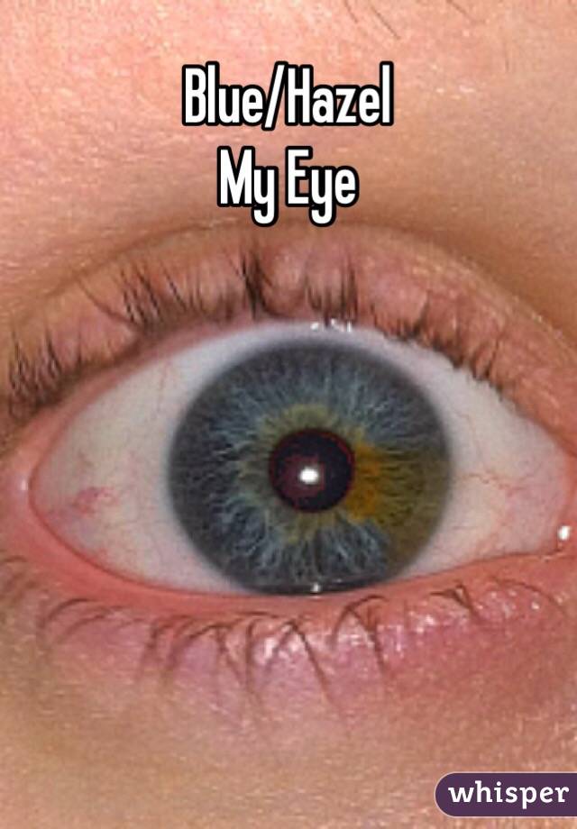 Blue/Hazel
My Eye