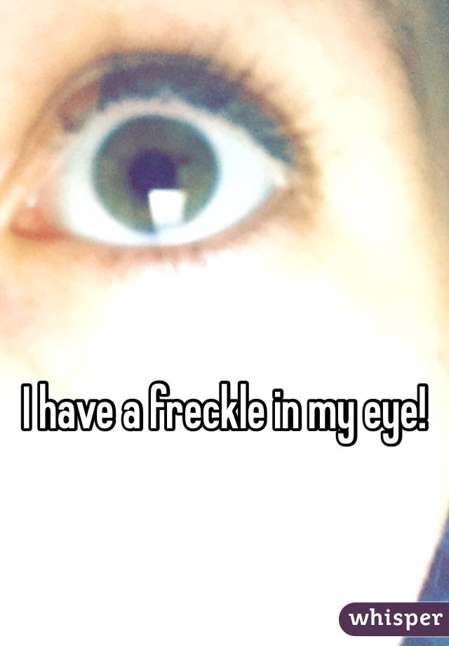 I have a freckle in my eye!