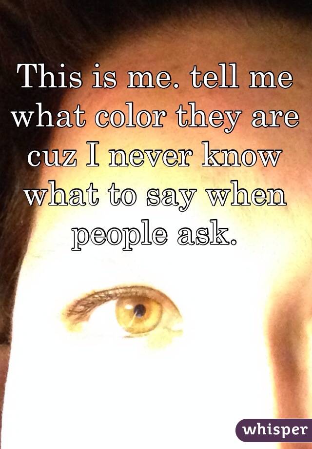 This is me. tell me what color they are cuz I never know what to say when people ask. 