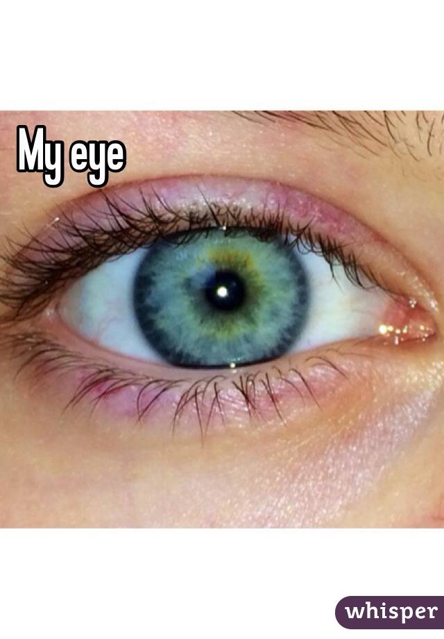 My eye 