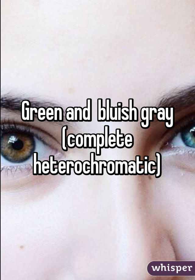 Green and  bluish gray (complete heterochromatic)