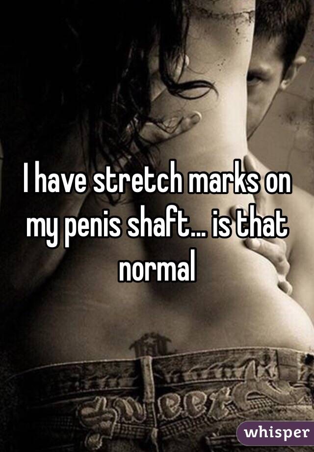 I have stretch marks on my penis shaft... is that normal