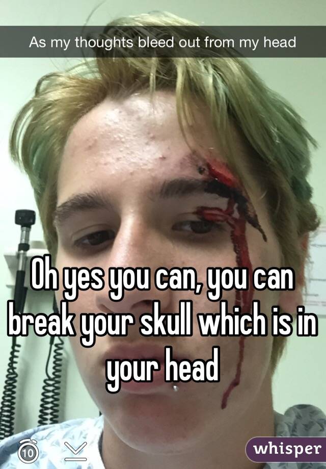 Oh yes you can, you can break your skull which is in your head