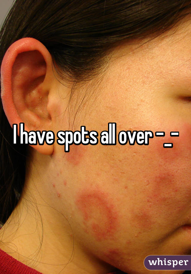 I have spots all over -_-