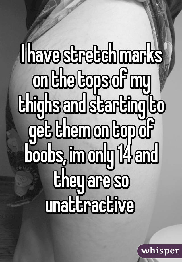 I have stretch marks on the tops of my thighs and starting to get them on top of boobs, im only 14 and they are so unattractive 